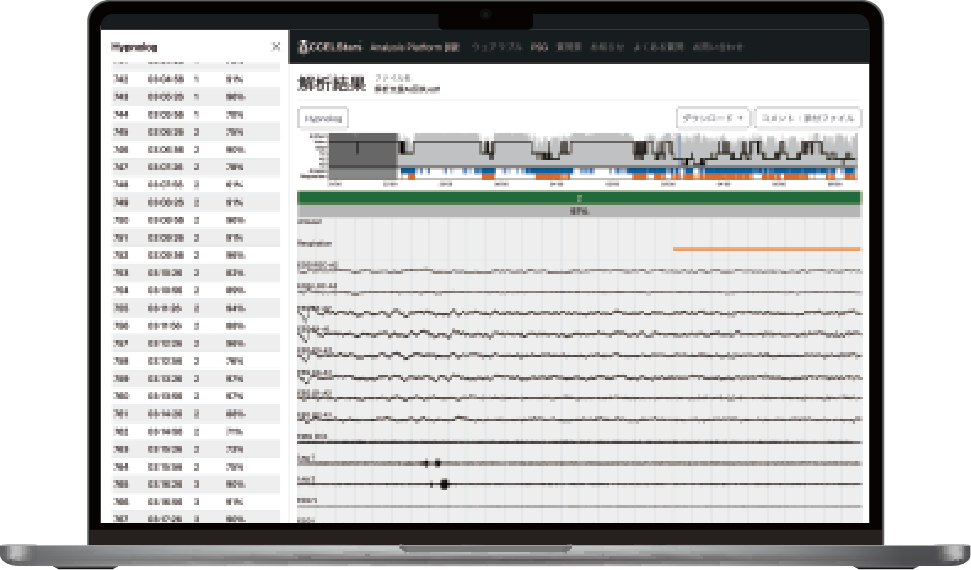 ACCELStars Analysis Platformの商品写真